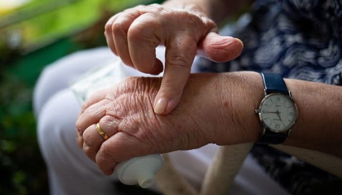 Mengenal Penyakit Arthritis, Lengkap Penyebab dan Gejalanya