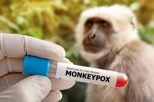 medical worker holds a test tube with Monkeypox virus infected blood sample in his hands,hands in gloves close-up against the background of a sad monkey. Animal epidemic. Epidemic of smallpox monkeys in Europe and the USA.