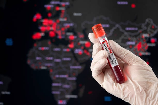 Monkeypox  positive blood tube and world pandemic map